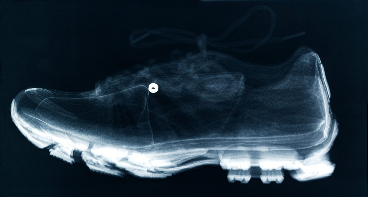 x-ray shoe side view radiograph