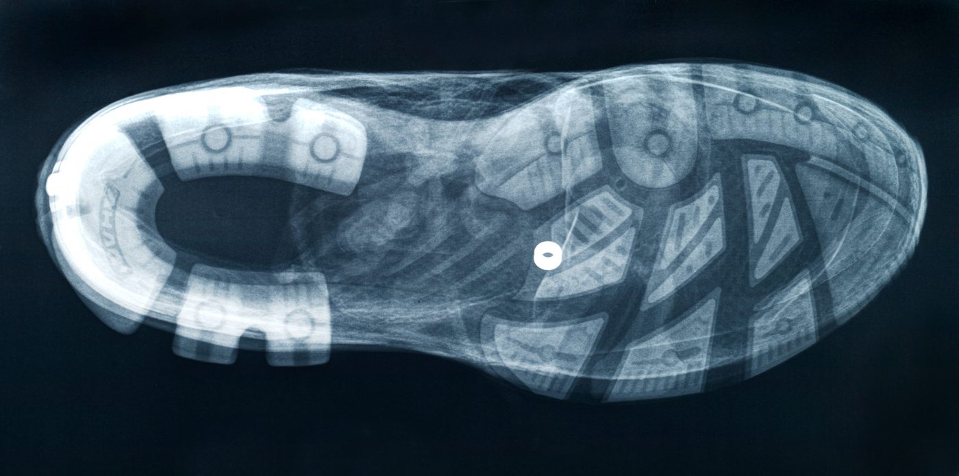 x-ray shoe worm´s-eye view radiograph
